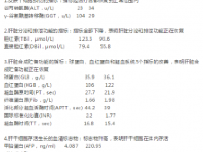 干细胞治疗肝硬化肝病，是替代肝移植治疗的有